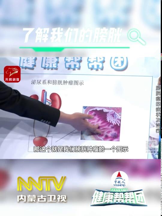 赵强医生科普小知识时间：了解我们的膀胱了解膀胱癌